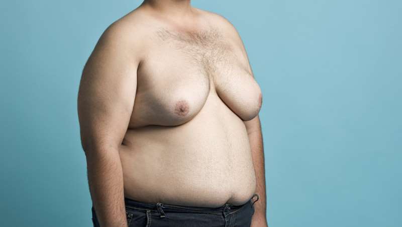 Gynecomastia-FAQ.jpg