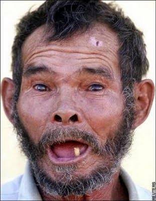 old+asian+man+with+only+one+tooth.jpg