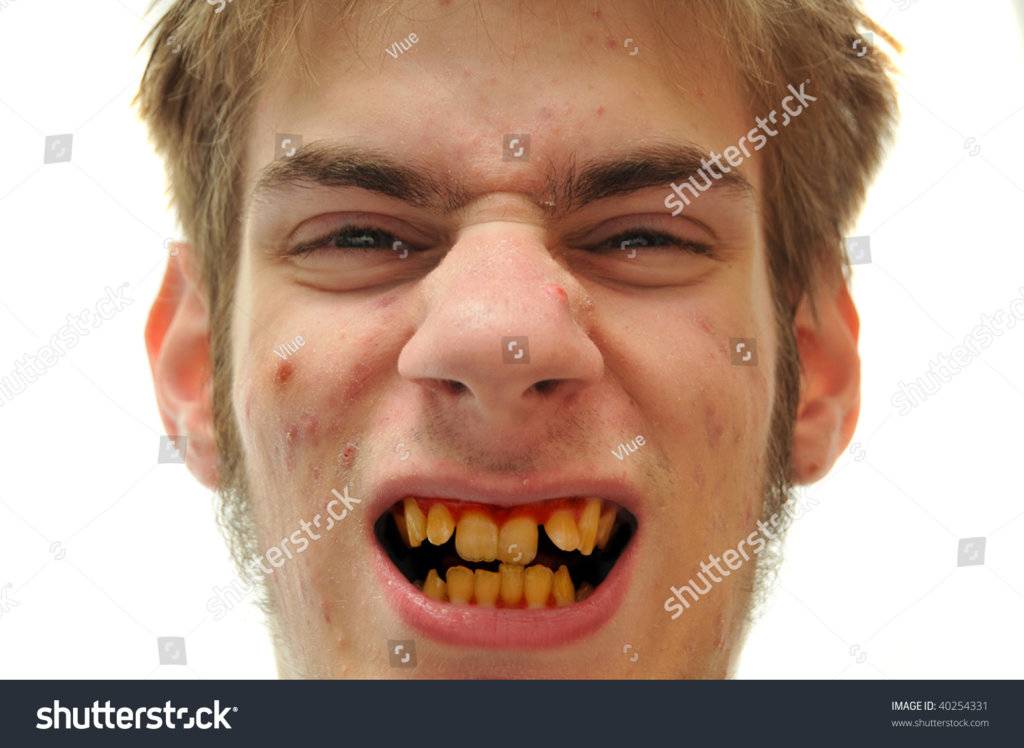stock-photo-ugly-man-showing-off-crooked-yellow-teeth-40254331.jpg